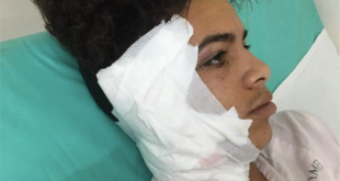 Adolescente trans sufre brutal agresión en Matanzas; piden al gobierno que tome cartas en el asunto