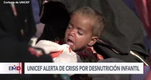 Casi dos millones de niños en riesgo de muerte por desnutrición severa