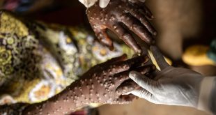 WHO maintains the international emergency for the MPOX in the face of the growing number of cases